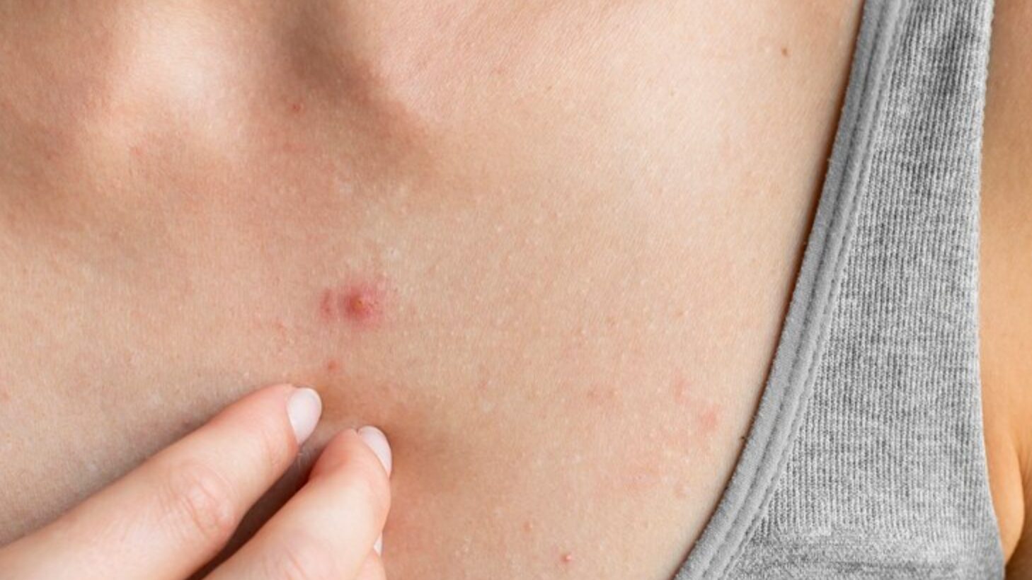 Ten todas las precauciones