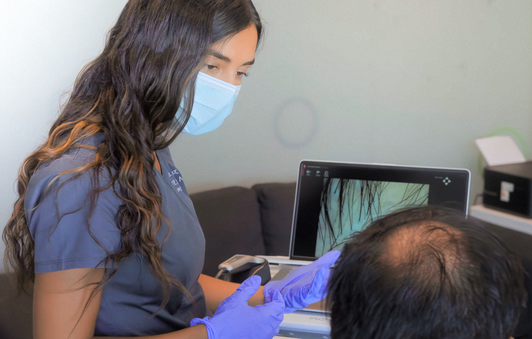 Alopecia en hombres: implante capilar se rejuvenece en Chile