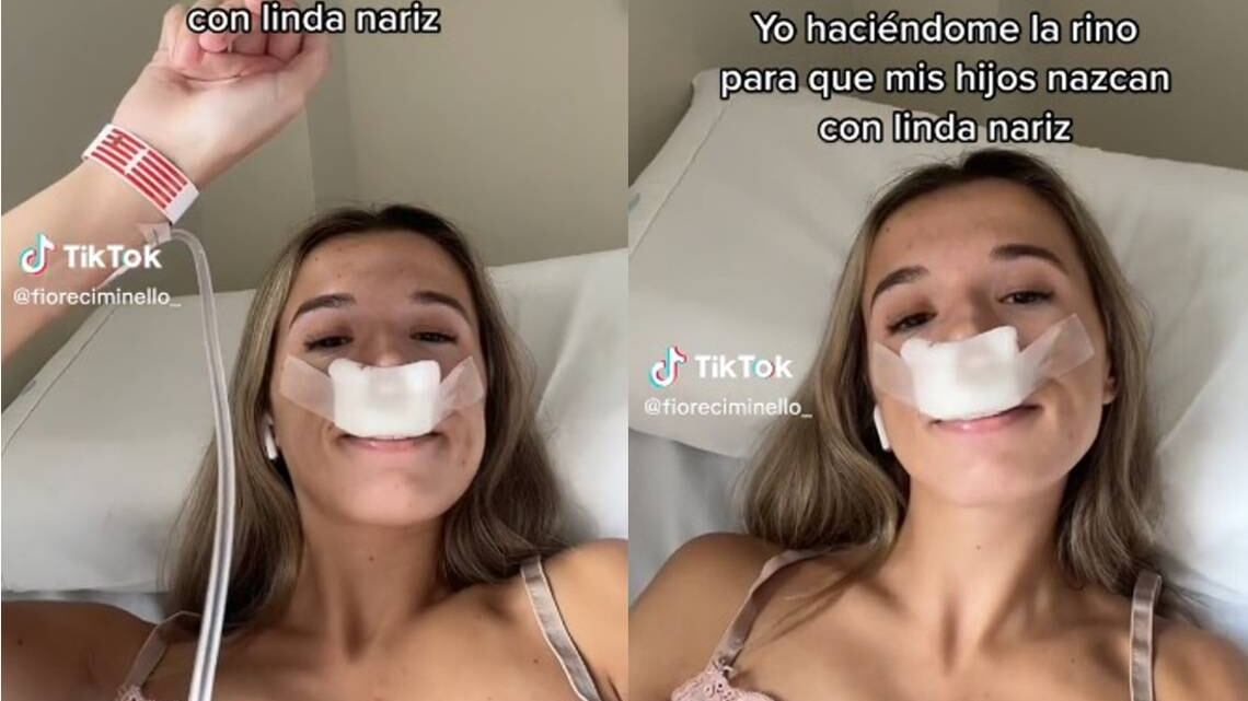 La genética no tiene relación alguna con las intervenciones estéticas