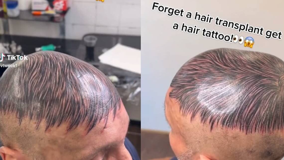 Generó críticas por los daños que puede ocasionar en la piel