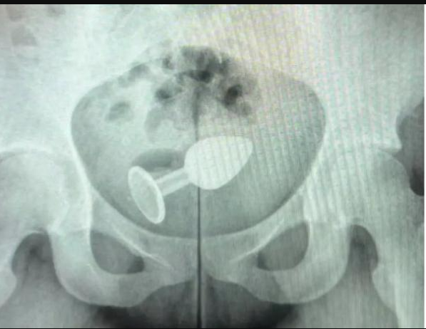 Radiografía