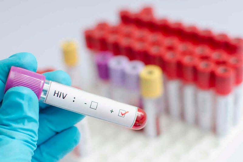 La estadística señala que una de cada siete personas desconoce que es portador del VIH y eso provoca una cadena de contagios que es la que se pretende frenar.