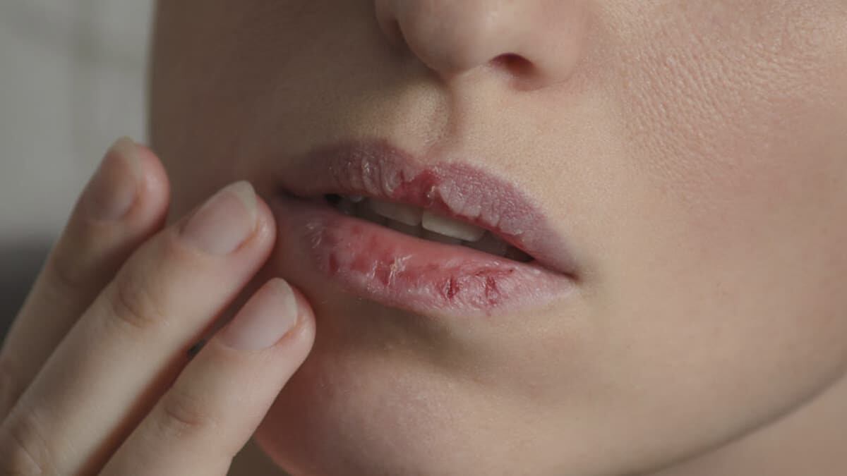 Para suavizar los labios secos debes hidratarlos.