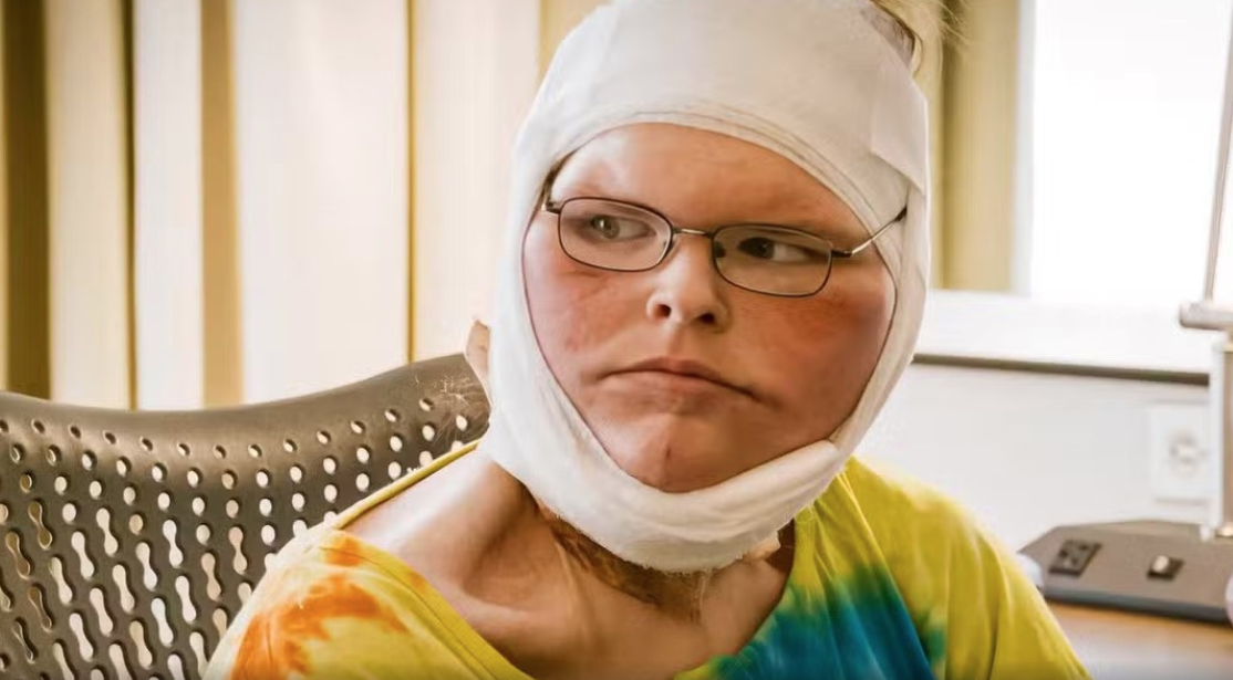 Tras bajar más de 200 kg, una de las hermanas de Kilos Mortales mostró el resultado de su cirugía de eliminación de piel