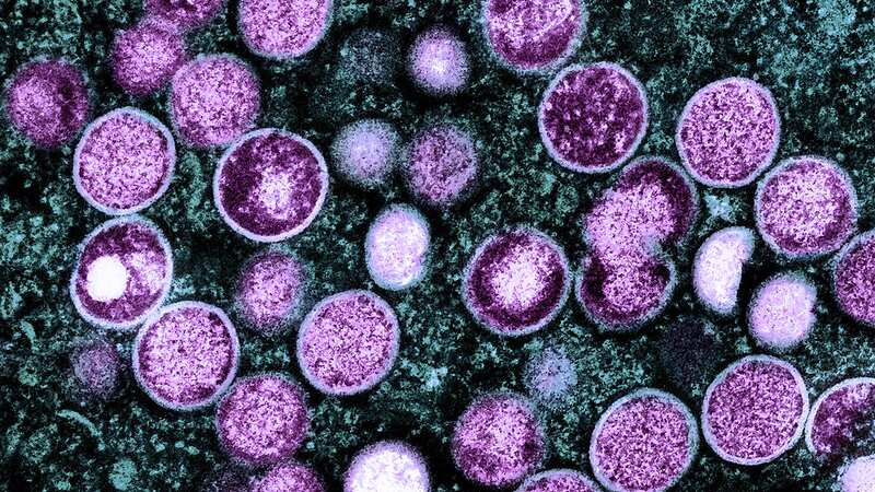 Virus de la viruela del mono; imagen de National Institute of Allergy and Infectious Diseases (NIAID)/ Flickr.