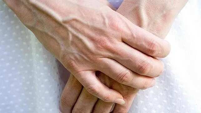 En la parte superior de las manos y los brazos es más delgada la piel y, por ende, se aprecian más las venas.