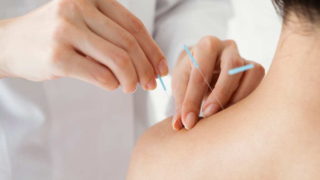 La acupuntura es una opción viable para aquellas personas que sufren de dolores crónicos.