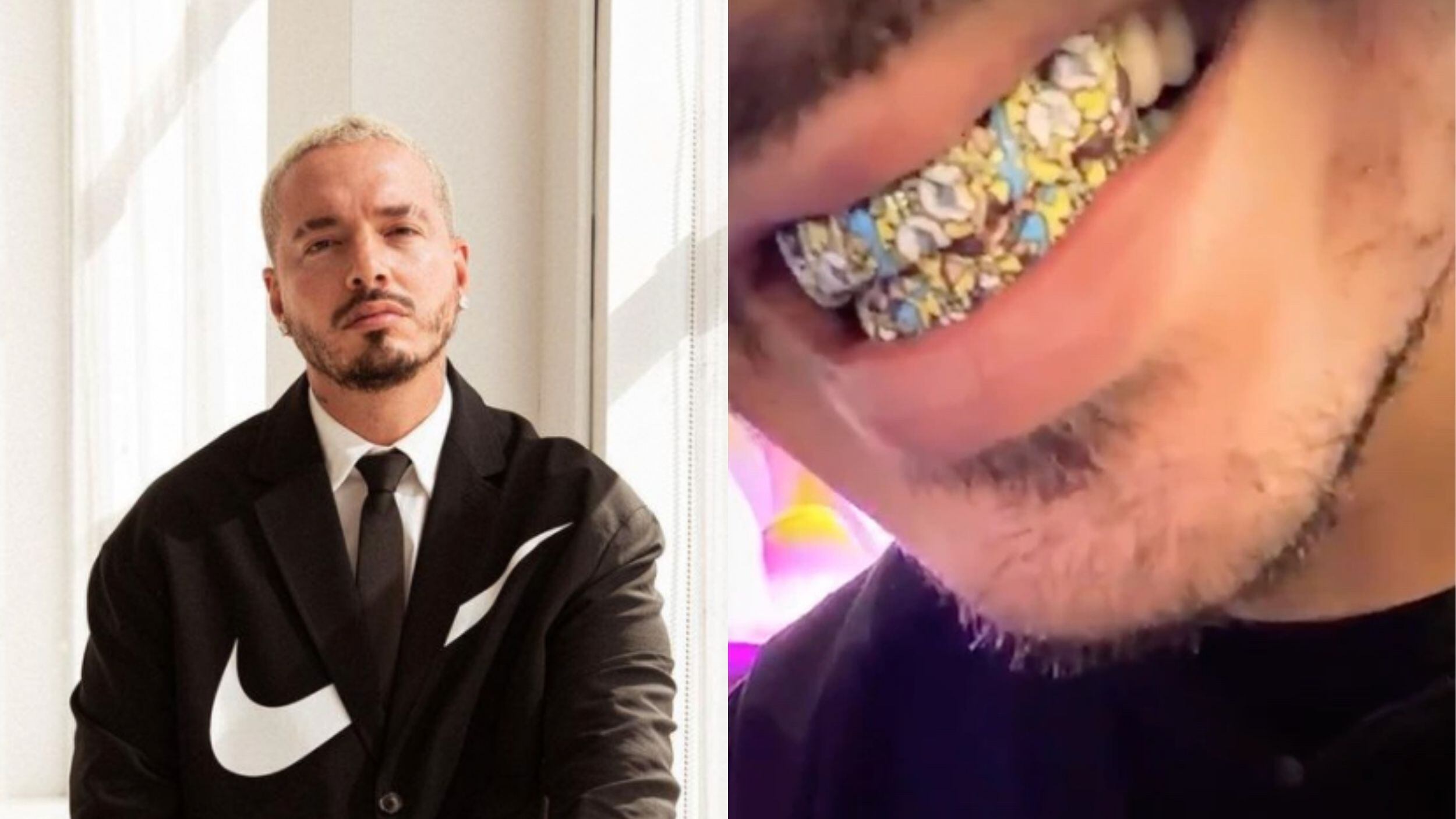 J Balvin y los famosos que se han unido a la moda de las incrustaciones de oro en los dientes