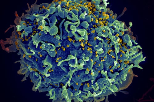 Autoridades de salud de EEUU identifican primeros casos de VIH por “faciales vampíricos”