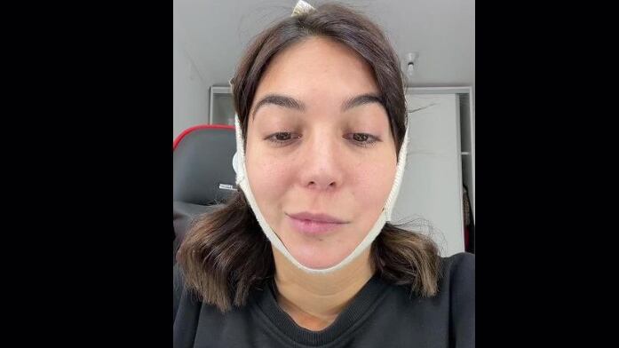 Luciana compartió su mala experiencia al operarse la papada