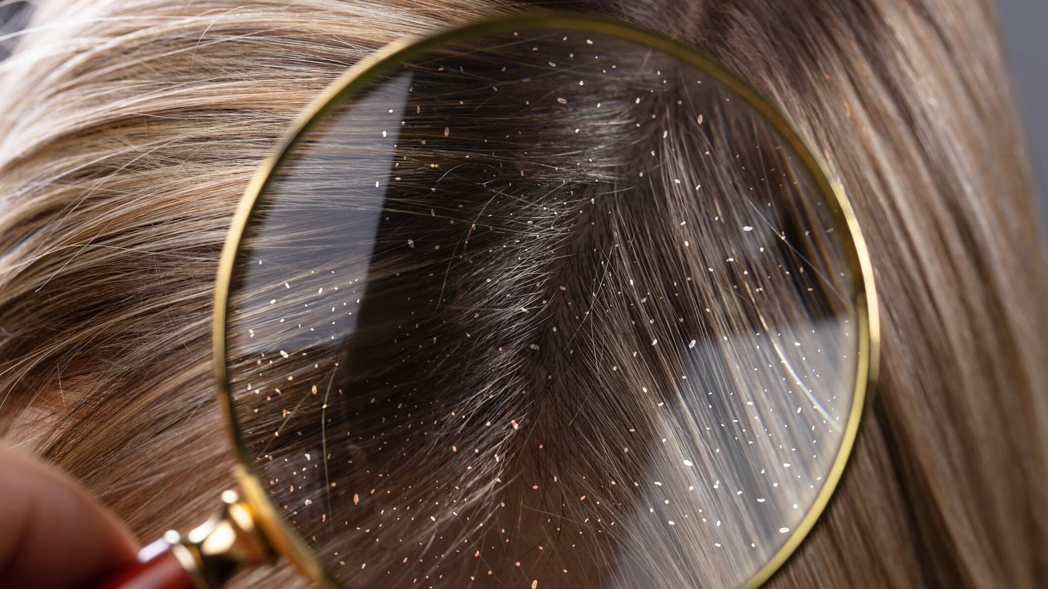 H&S Advanced contra la caspa