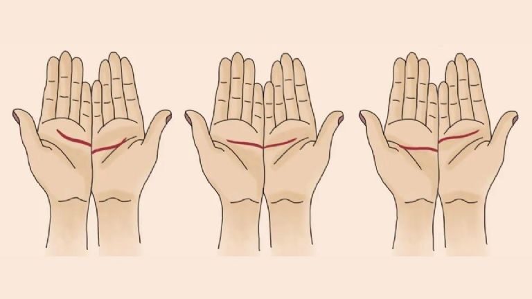 Elige una de las opciones.