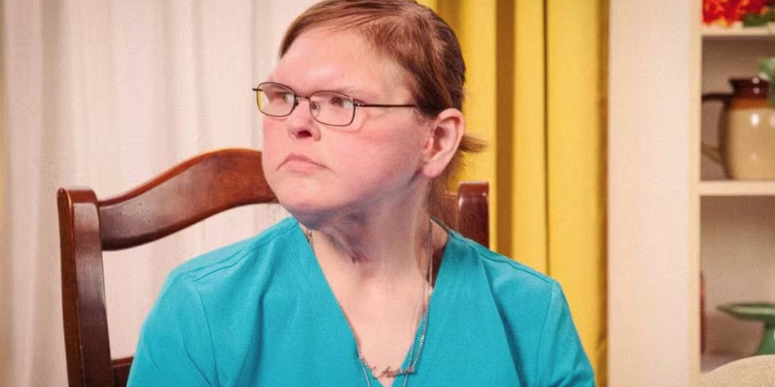 Tras bajar más de 200 kg, una de las hermanas de Kilos Mortales mostró el resultado de su cirugía de eliminación de piel.
