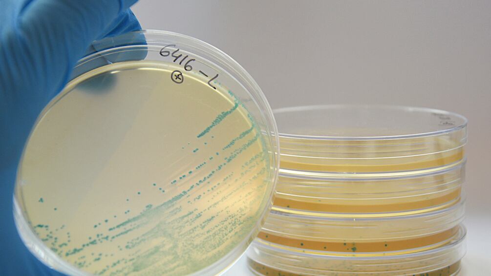 Posible contaminacion con Listeria alerta al mercado en Estados Unidos | Foto: Referencial