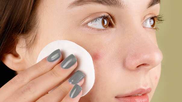 Cuidado piel seca y acné