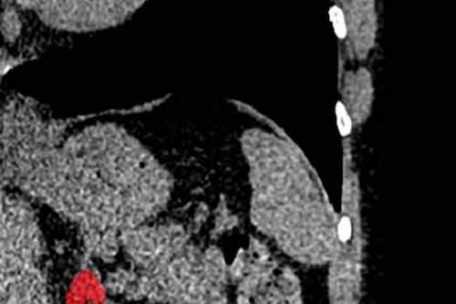 Por primera vez es posible ‘ver’ el estrés crónico gracias a la IA
