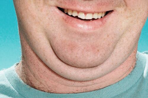 Dile adiós a la grasa en el cuello sin cirugías