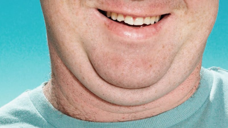 Foto de persona con grasa en el cuello