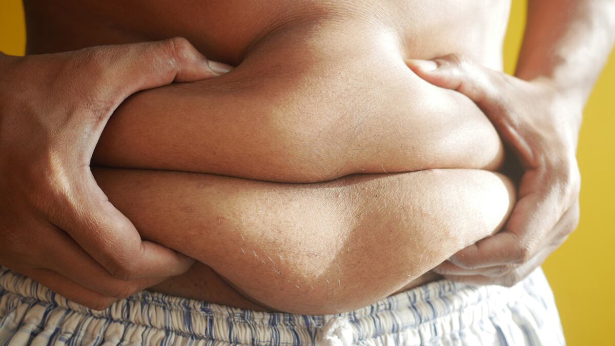 Obesidade