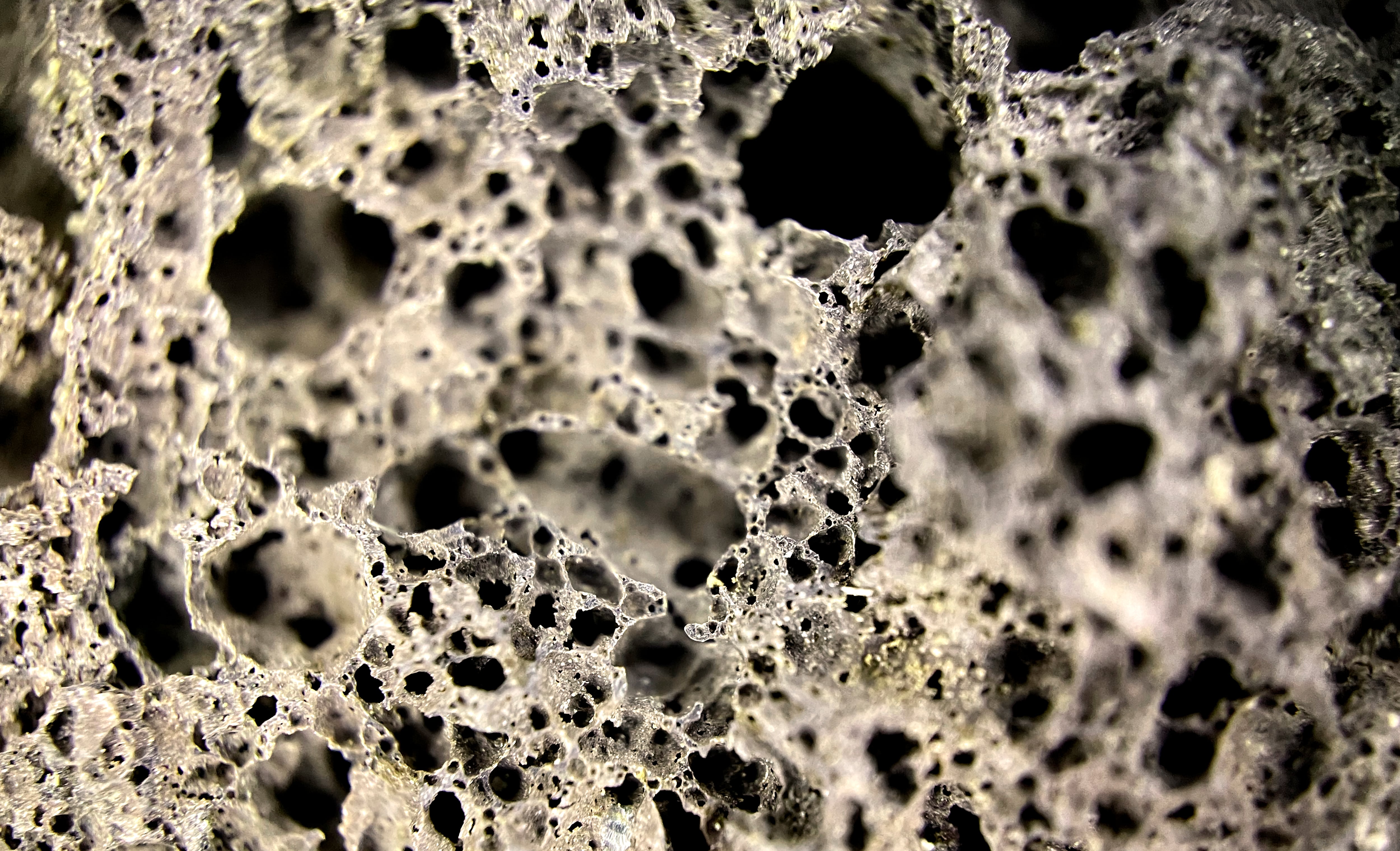 Osteoporosis: la enfermedad silenciosa que causa 70 fracturas por minuto en el mundo