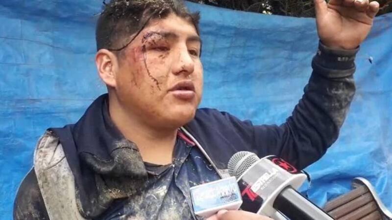 Las autoridades desestimaron su versión