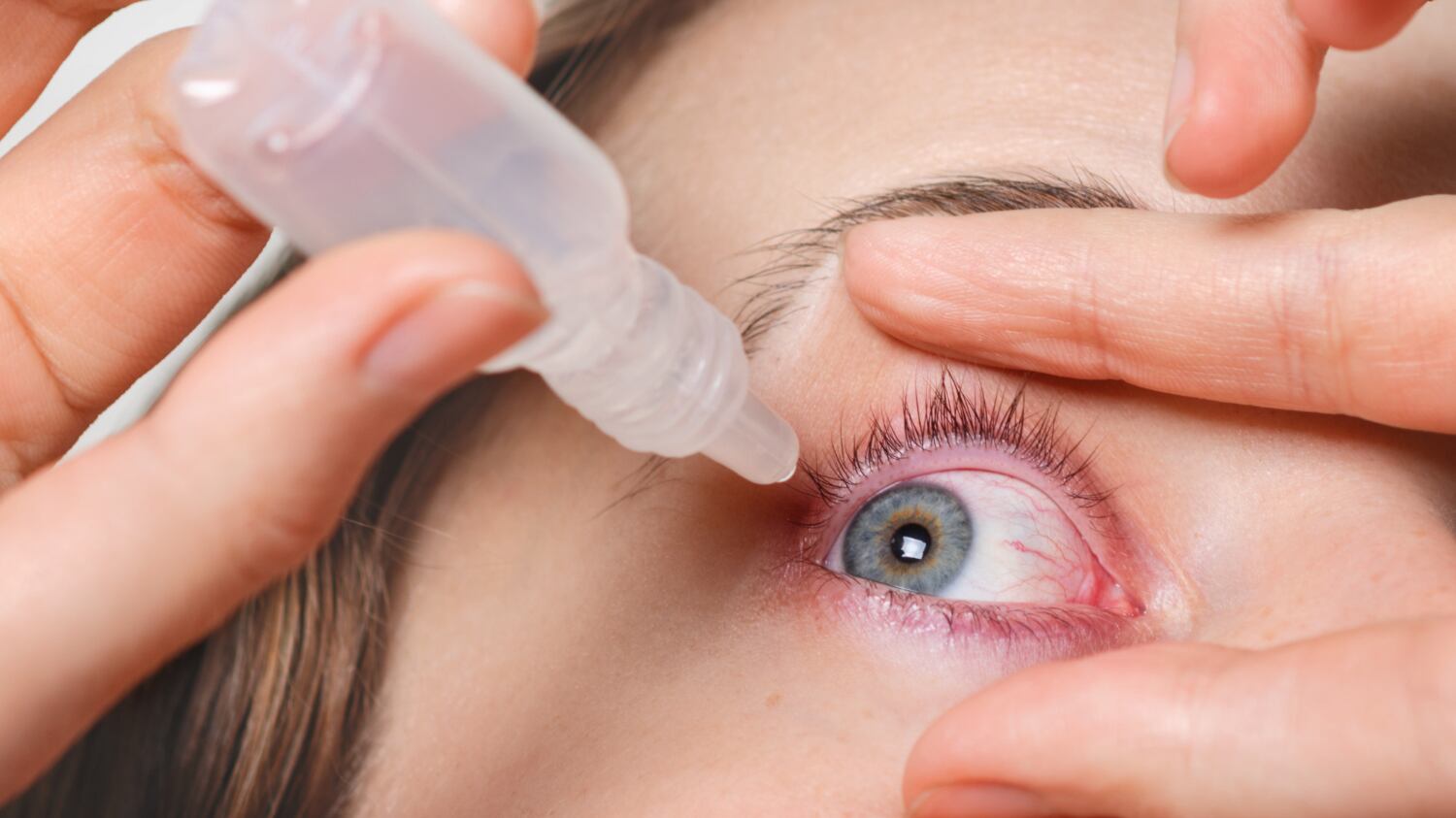 La mayoría de los afectados dijeron haber utilizado colirios antes de sufrir los problemas médicos. | Foto: Referencial