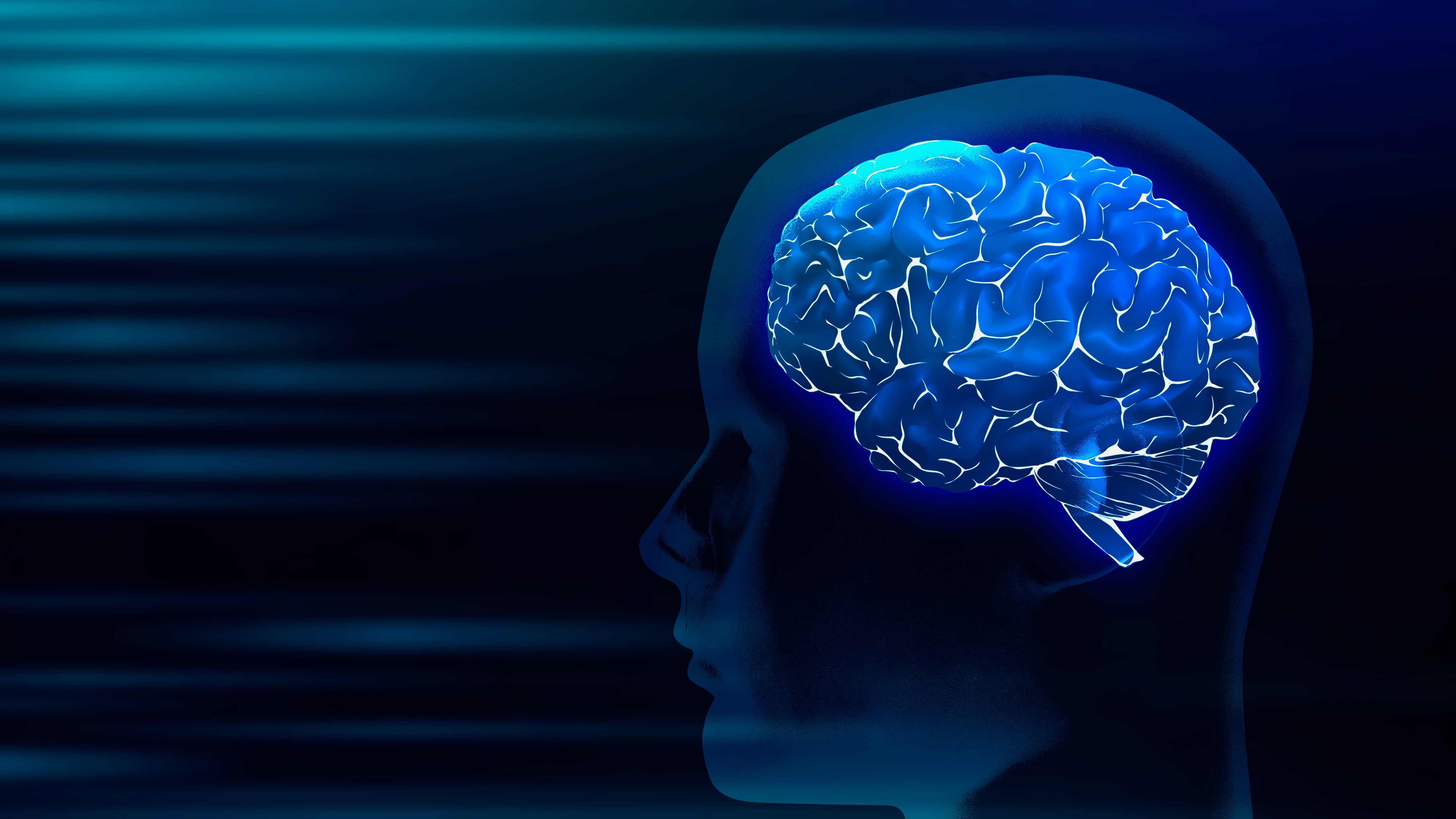 Cerebro