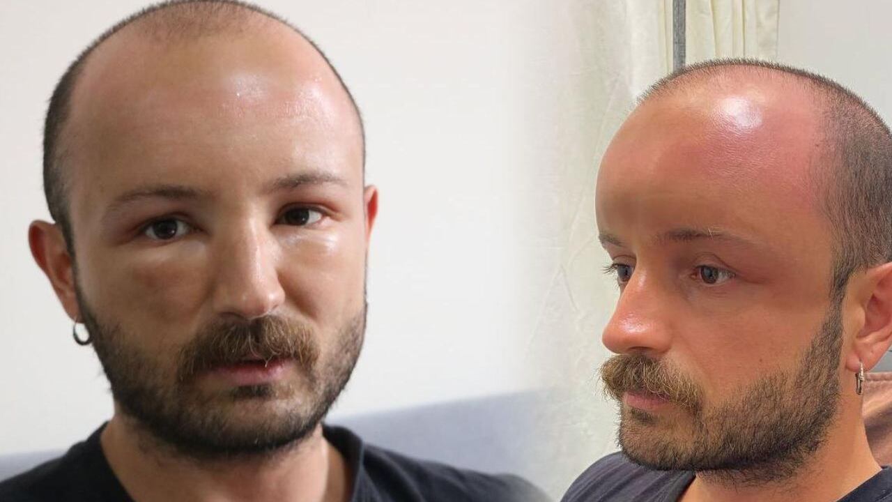 El hombre simplemente fue a vacacionar a la playa