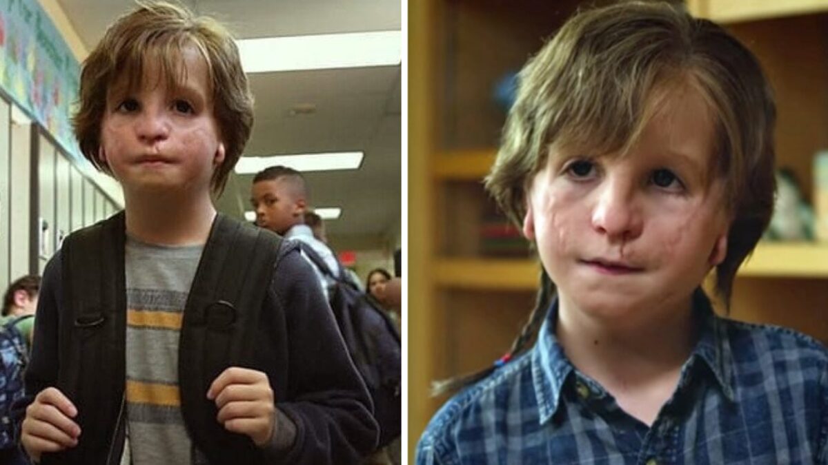 Así luce el niño de Wonder sin maquillaje