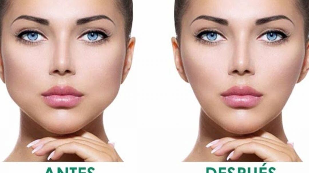 Este procedimiento busca perfilar el rostro