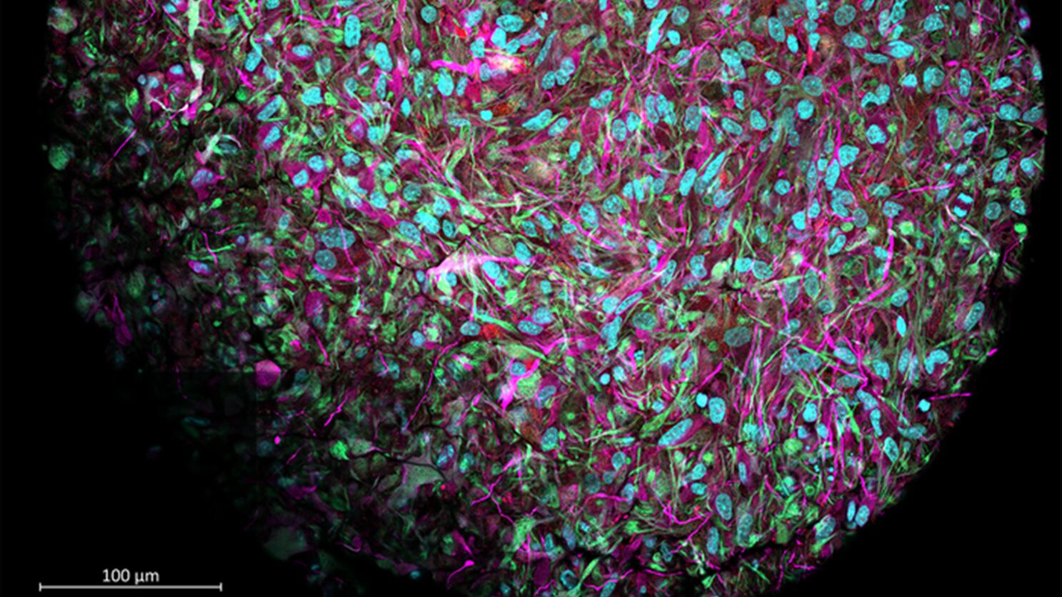 Organoides cerebrales