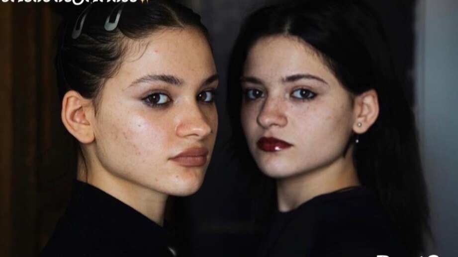 Amy y Ano, gemelas separadas al nacer