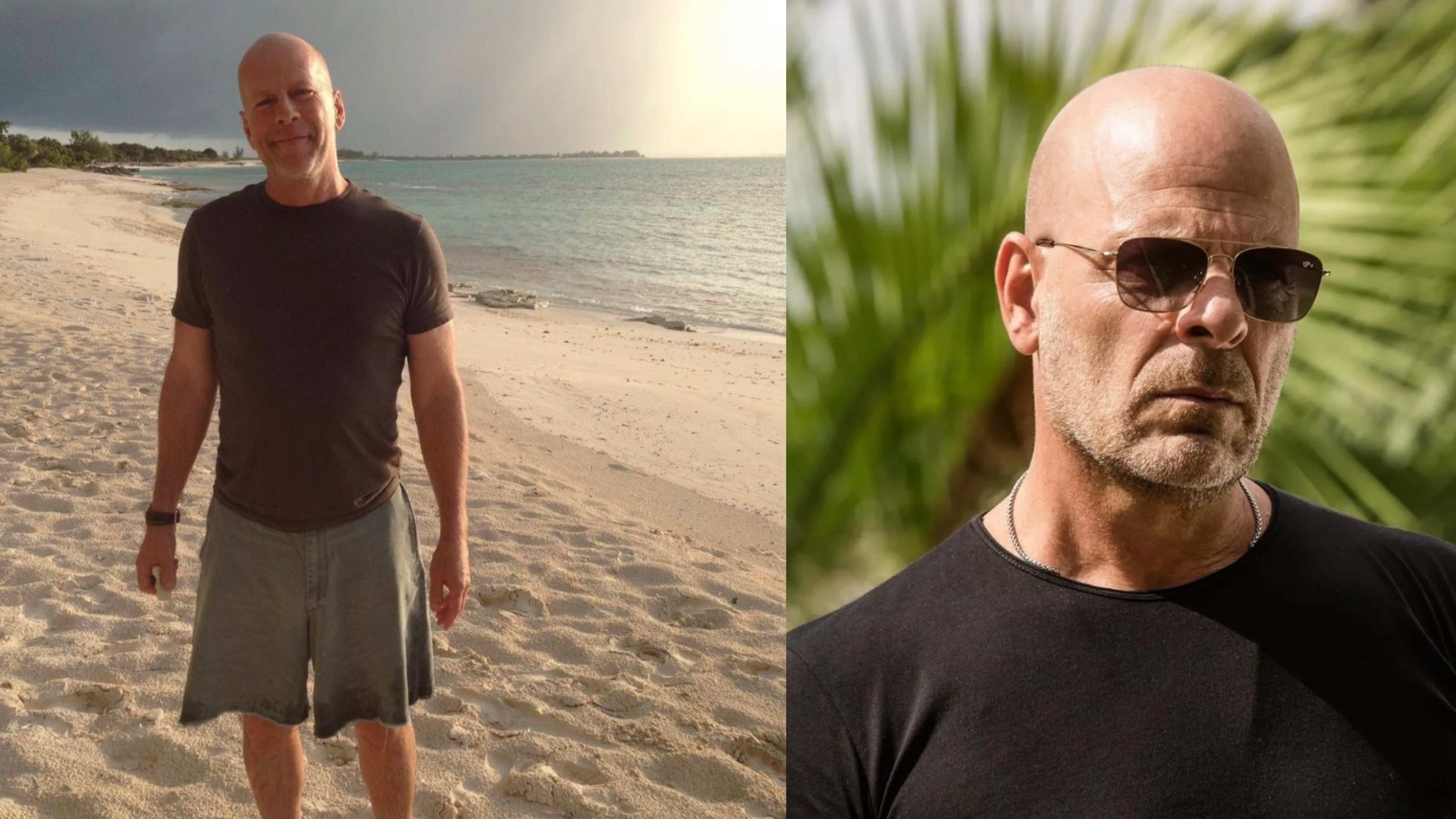 El actor alemán padece de una enfermedad que es irreversible y eventualmente pasará factura