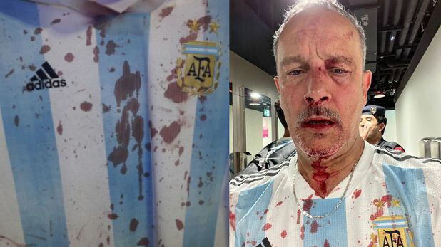 Aficionado argentino terminó ensangrentado por los ataques de hinchas mexicanos.