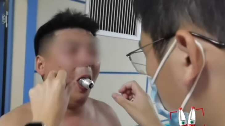 Al hombre tuvieron que operarlo para sacar el bombillo de su boca