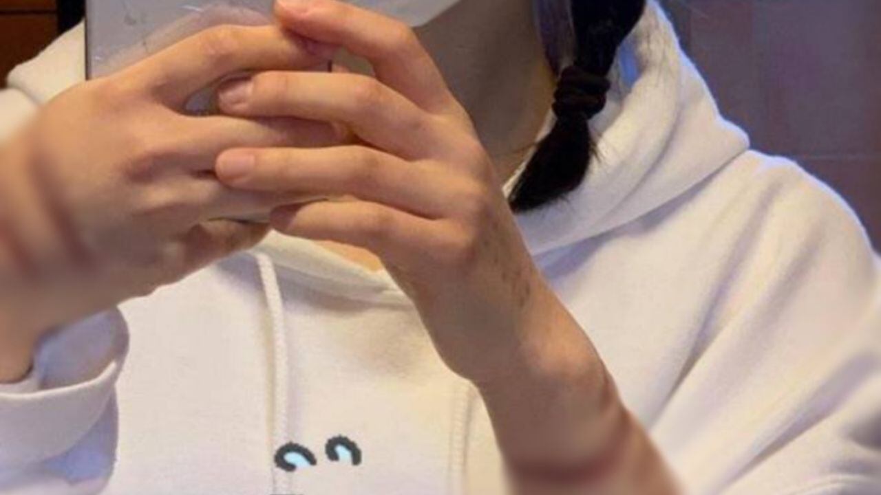 Una mujer se hizo viral en Twitter por mutilarse y comer partes de su cuerpo.