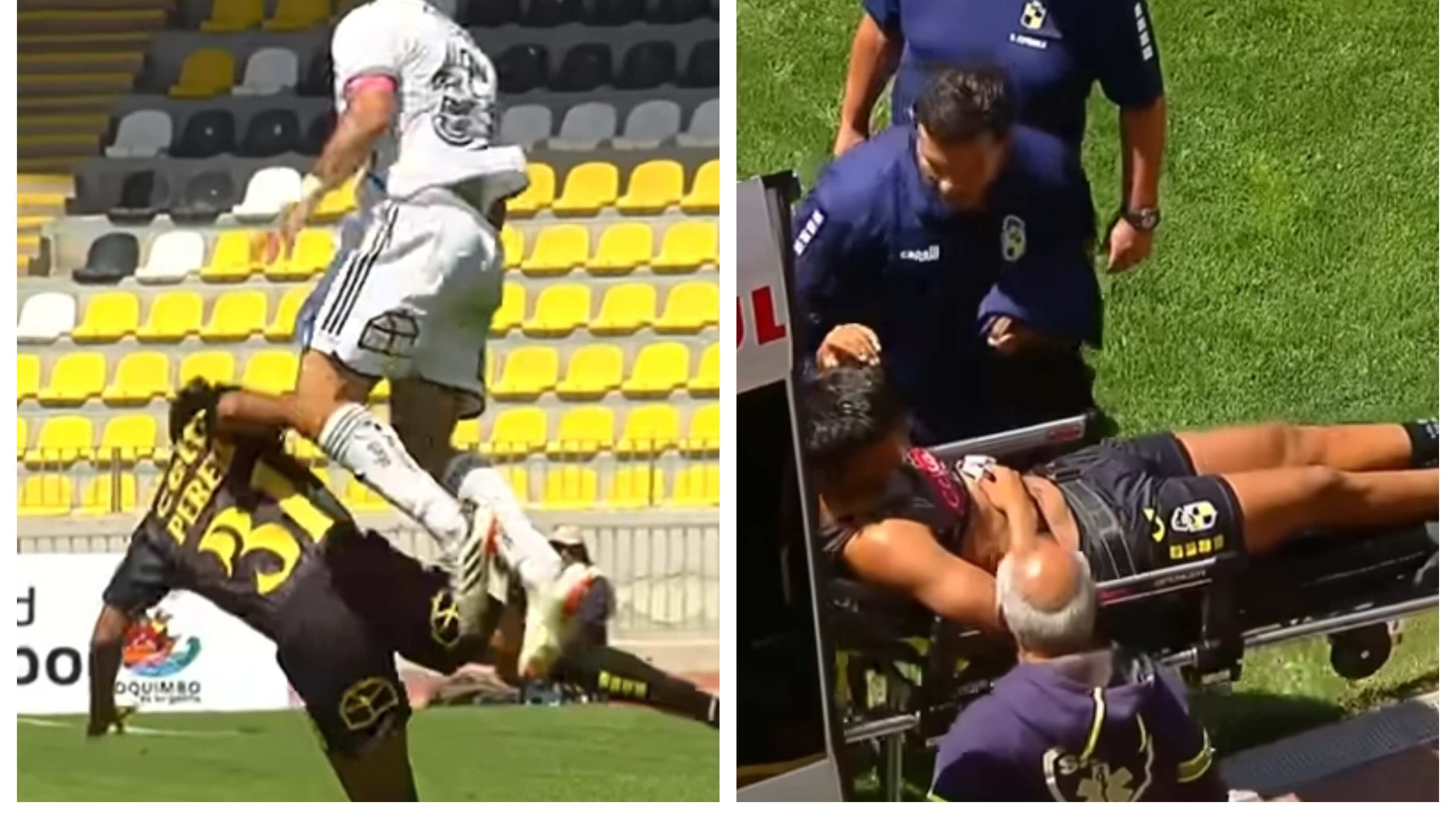 El defensor de Coquimbo no cree que Falcón fuera directo a pegarle en la jugada que le significó lesionarse y quedar tres meses sin poder practicar fútbol.