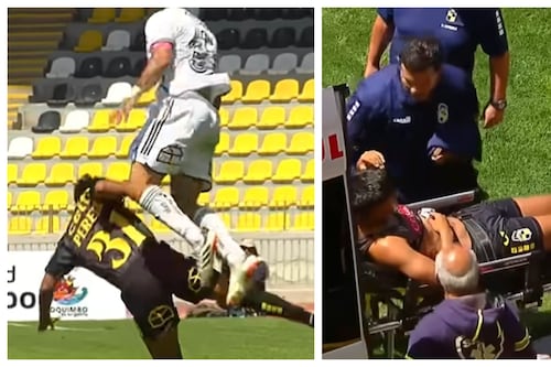 “Prefiero verlo así”: juvenil de Coquimbo fracturado tras rodillazo de Falcón no cree que defensor albo “fuera directo a pegarme”