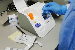 FDA alerta sobre deficiencias de prueba rápida de coronavirus