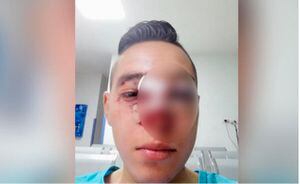 La brutal golpiza que recibió un joven luego de llamar "tombo" a un Policía en Bogotá