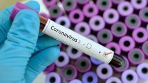 Coronavirus: Estos son los síntomas que presenta en los humanos